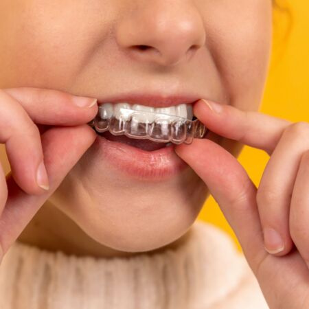 Was Sie gegen Zähneknirschen tun können, erklären Ihnen Ihre Zahnärzte am Riedberg.